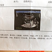 各位亲，现在能看出来男女吗