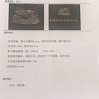 能看出男孩女孩吗