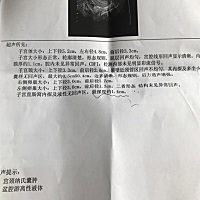 请问有医生在吗？我这种情况需要治疗吗？还是可以正常备孕？求指教