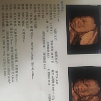 亲们，有没有能看出男孩女孩的？