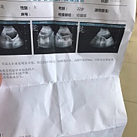 前天早孕试纸测出二条线。去医院检查B超检查又没怀孕。今天早上跟昨天早上又都能测到两条线。亲们知道是...