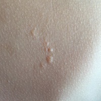 有没有宝妈知道 这是长了什么吗？不痛不痒不红  几天前发现的