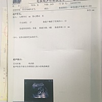 麻烦问一下，这个是NT检查单吗？