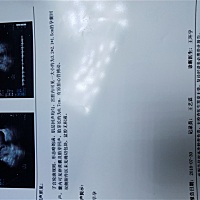 没有备孕，无意中有的宝宝。这是意外之喜。希望所有备孕的姐妹，能够心想事成，一招得子。