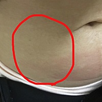 这个位置老是胀痛，有点酸，有点紧绷，感觉是内部痛，不是表皮，请问有没有人跟我一样的呢？到底是什么...