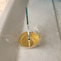 怀疑自己怀孕应该有10天左右了，生理期是8月1号，明天就要去医院检查了，一般会检查什么？抽血还是尿检...