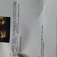 这个是什么情况？？？