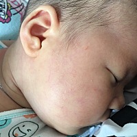 新手妈妈，宝贝四十多天了，请问有经验的宝妈，宝贝脸上起的疙瘩是怎么回事？