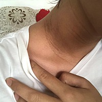 你们脖子上有吗？有经验的宝妈告诉我一下生完能下去吗