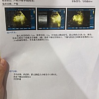 孕13周+4天，本来以为过了3个月终于安全了，今天去医院打彩超，医生说胎盘怀的太低，宫腔还有积液，问我...