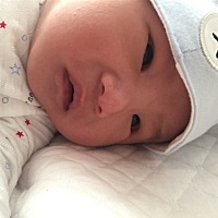 宝宝出生鼻头中间就有一条竖线，怎么回事啊，会不会消啊，急啊