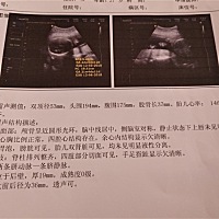 怀孕23周，不知道是男宝还是女宝，各位有经验的宝妈帮忙看下🙏️