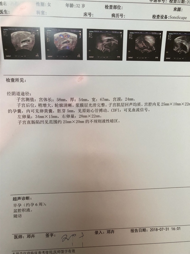 大家帮我看看单子啊，都十几天了，每天都有一点点褐色分泌物，这个单子上说有流血信号，好怕啊！