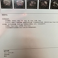 大家帮我看看单子啊，都十几天了，每天都有一点点褐色分泌物，这个单子上说有流血信号，好怕啊！