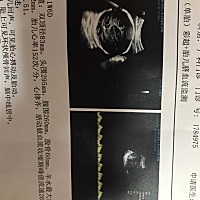 大家帮我看下是男宝还是女宝