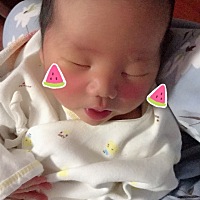 我们十天啦   长得像女孩子   有点黄疸    有点着急   除了晒太阳有什么好办法么