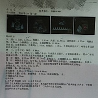 四维＋大排畸顺利通过 有经验的宝妈帮忙看下是男孩还是女孩😊