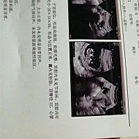 : 能看出男孩女孩吗？求解