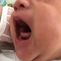 宝宝一个月腮帮子里面两侧肉很厚，像肿了一样，这是怎么回事呀，有知道的吗