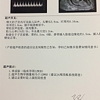 帮我看看胎心好高哦，是不是胎心高就是女孩