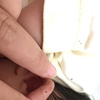 今天才看到宝宝耳朵上有个洞 不知道是什么 有知道的吗？