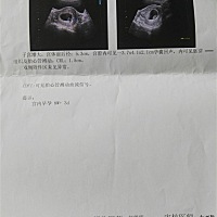 8周 3都说这三个数据可以看男女，有这个时间段相同数据的宝妈吗？来报下数据生下来看看是男宝女宝😊