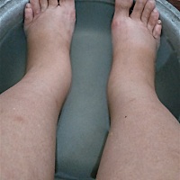 离预产期还有四十七天，脚肿的厉害，幸好不痛。