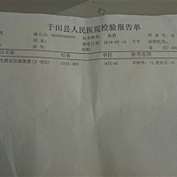 看了几个关于胎心的帖子，其实我也在担心这个问题，7周了没有胎心，抽血化验一切正常，医生也说再等等看...