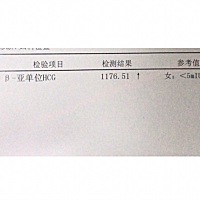 请问大家，这是怀上了么？今天早上做的血检、但是还要做B超