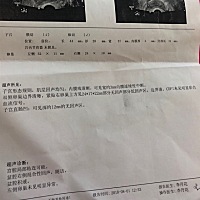谁能帮我看看这个正常吗？谢谢！