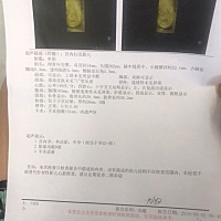 四维彩超结果，懂的宝妈麻烦看一下性别