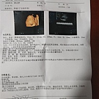 大家帮我看看正常吗