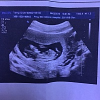 宝妈们帮我看看是男孩还是女孩