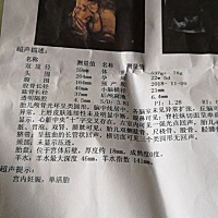 四维检查左心室一强光点。有没有事情啊，求有经验的宝妈