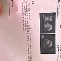 担心一个多月，心终于踏实了！！！