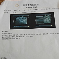 上面怎么有两个小白点，医生也没说，大家知道是怎么回事吗？