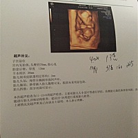 有谁看的懂这个彩色超声检查报告单那个医生太不负责任了问她宝宝发育的怎么样了她也不说