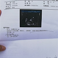 12周NT过了     就是说胎盘低   说后期会长