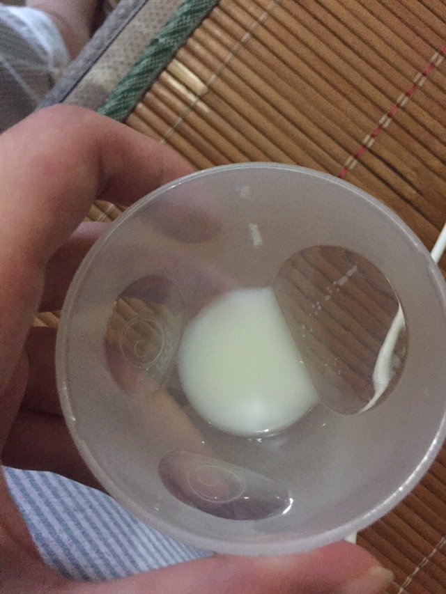 各位姐妹们，我昨天晚上喂奶之前胸涨，喂完不久之后更涨，然后发高烧，今天早去去医院打退烧针，现在烧退了。但是发现右胸还是涨，而且右胸的奶是有点黄色，第一张图是左胸的 请问这样可以给宝宝喂奶吗？这个颜色正常吗？是什么原因知道吗