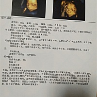 刚刚做的四维，从单子上能看出男孩女孩吗？二胎，大宝女儿，医生说不一样，会是男孩儿吗？胎心快，不是...