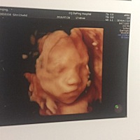 四维结果，头胎，一直想要个女儿，但是最近有人跟我说是弟弟，不重男轻女，也不重女轻男，就是很想知道...