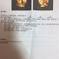 各位宝妈，帮忙看看像男宝宝还是像女宝宝。