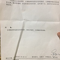 今天刚刚做了造影，好痛啊。左边畅通，右边堵着。然后我去外面的小诊所拿了中药自己灌肠。不知道有没有...