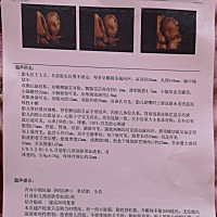 大家帮忙看看，宝宝是否一切正常，四维彩超做的比较早，担心不准，现在可以看出男宝女宝吗？