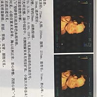 麻烦各位小伙伴们帮我看下，这是通过了吗，还是没通过啊？宝宝很不配合医生拍照，脸都给藏起来了，太顽皮了