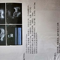 各位宝妈帮忙看下是男宝还是女宝，好好奇～