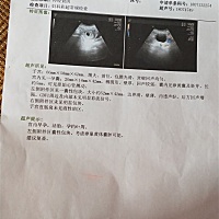 帮我看看我的单子