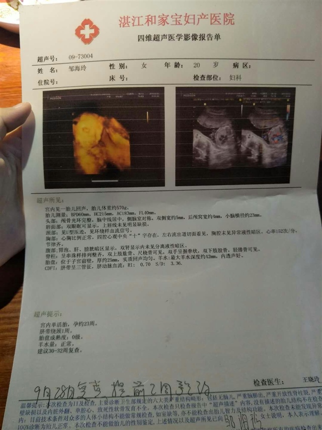 猜猜男孩还是女孩