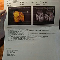 四维顺利通过  宝宝很配合  ✌✌✌ 猜猜男孩还是女孩