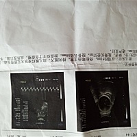 到底男孩女孩啊